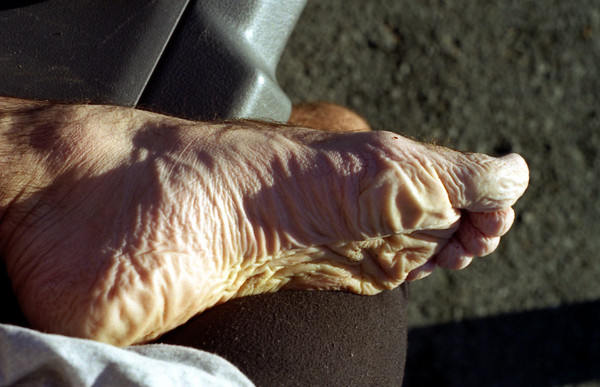 019_wrinkled_foot.jpg